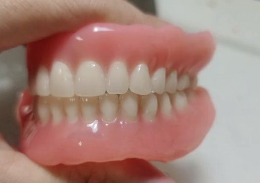 吸附性义齿和普通义齿有啥区别#牙好一生