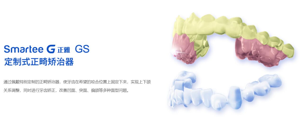 正雅gs隱形矯正成效怎么樣
