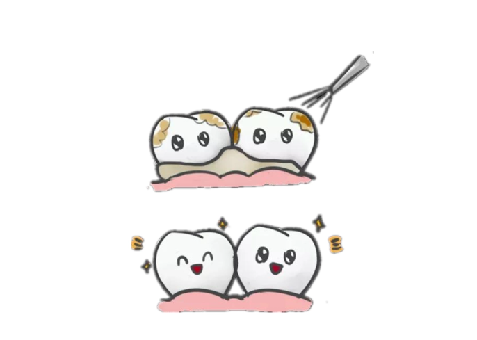 牙齒清潔
