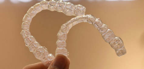 为什么医生推荐钢丝不推荐隐形牙套？