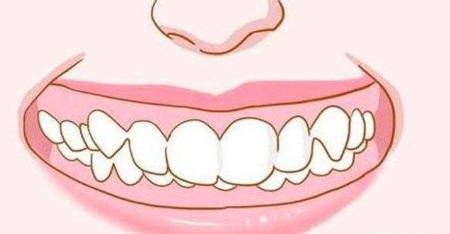 上牙包住下牙的多少算正常范围呢？