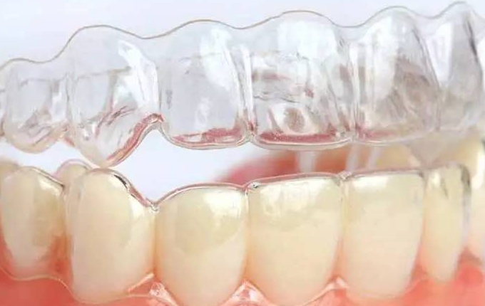 上牙包住下牙怎么矫正呢？