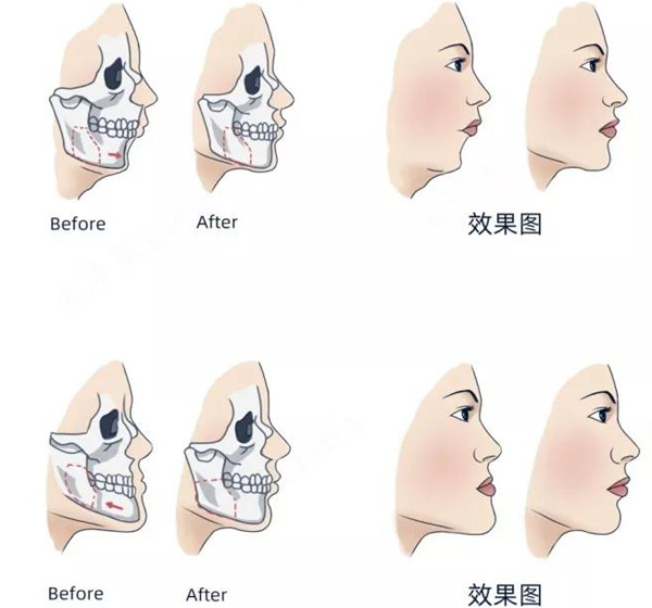 广州广大口腔正颌价格hszkq.cn