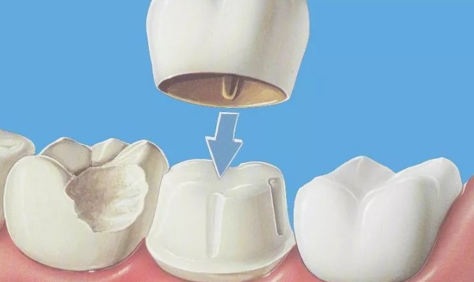 北京中諾口腔醫(yī)院是私立醫(yī)院嗎？正規(guī)私立口腔，口碑不錯(cuò)