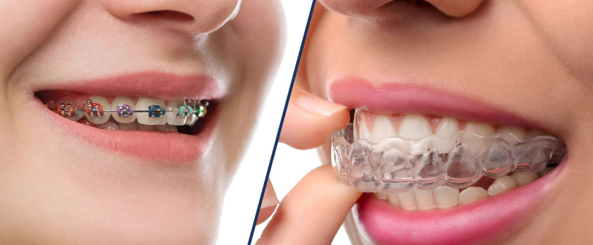 張棟梁正畸水平怎么樣？水平不錯(cuò)價(jià)格不貴