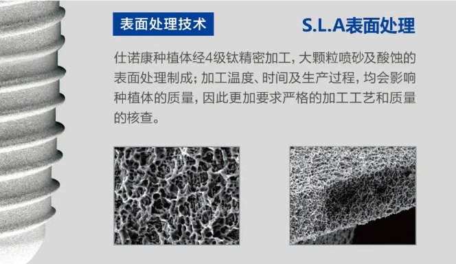 仕諾康植體介紹