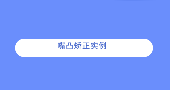 嘴凸矯正實(shí)例