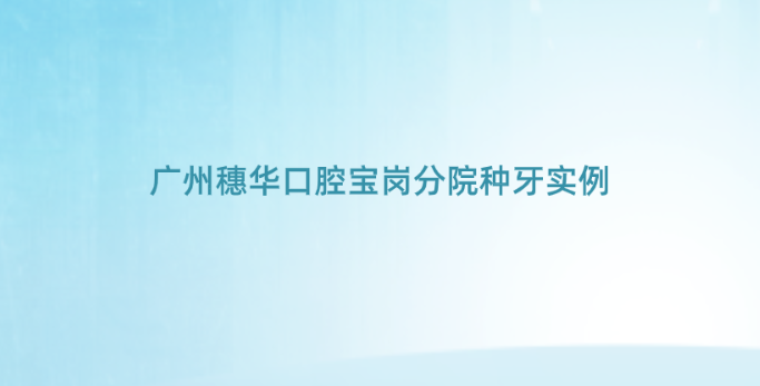 廣州穗華口腔寶崗分院種牙實(shí)例