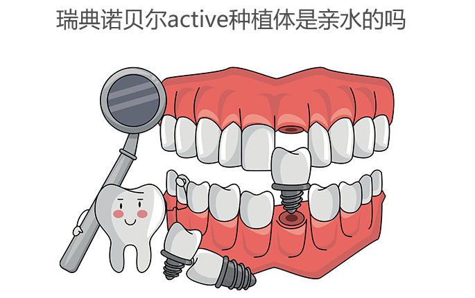 諾貝爾active種植體是親水的嗎