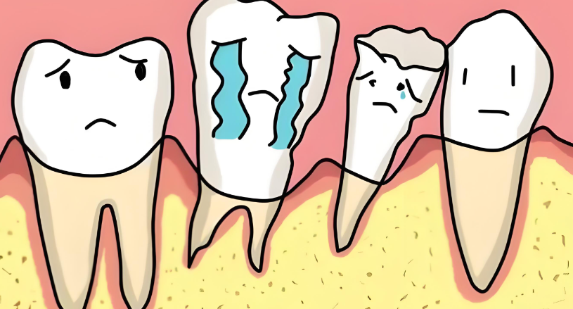 牙根吸收牙齿松动怎么办？