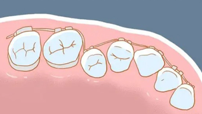 福州登特口腔臺江區牙齒矯正怎么樣？
