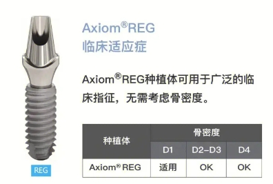 法國安卓健種植牙的檔次