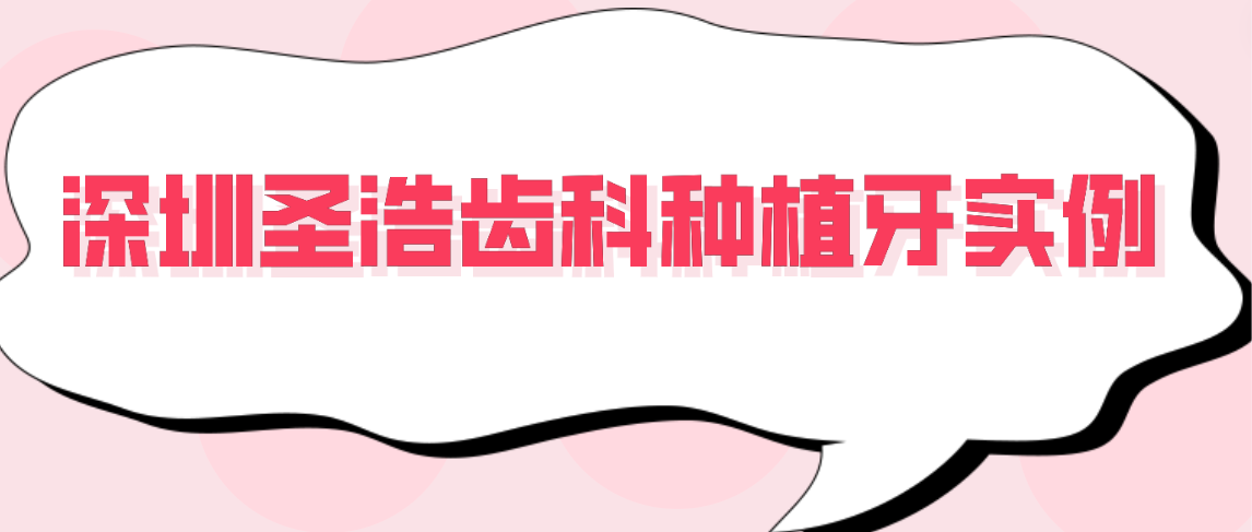 <!--<i data=20240703-sp></i>-->齒科種植牙實(shí)例