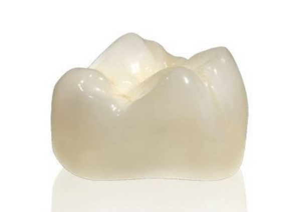 門(mén)牙做愛(ài)爾創(chuàng  )品牌的玉瓷怎么樣