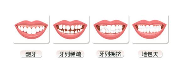 30岁后矫正牙齿容易反弹吗
