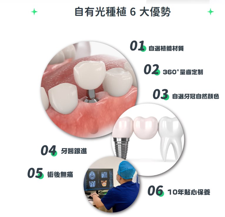 深圳自有光口腔种植牙6大优势：