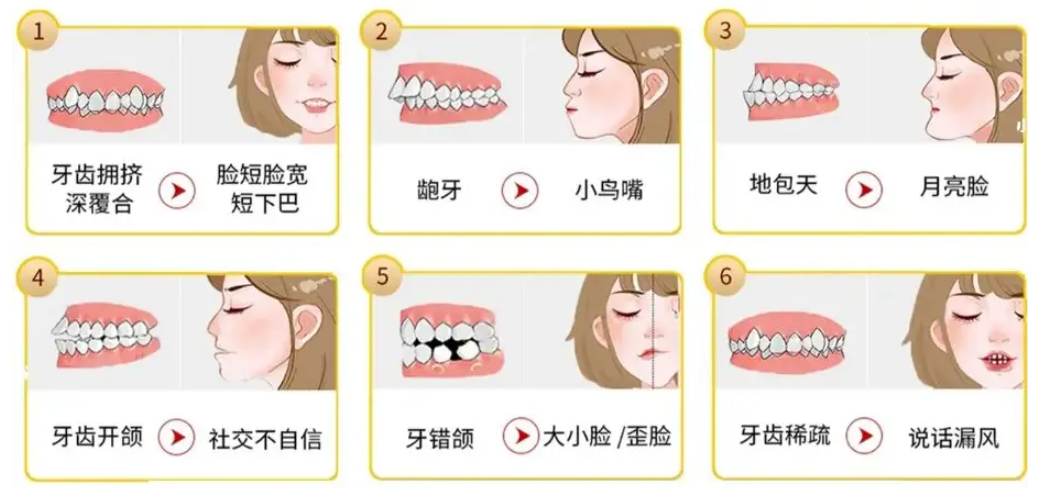 成都極光口腔矯正價(jià)格