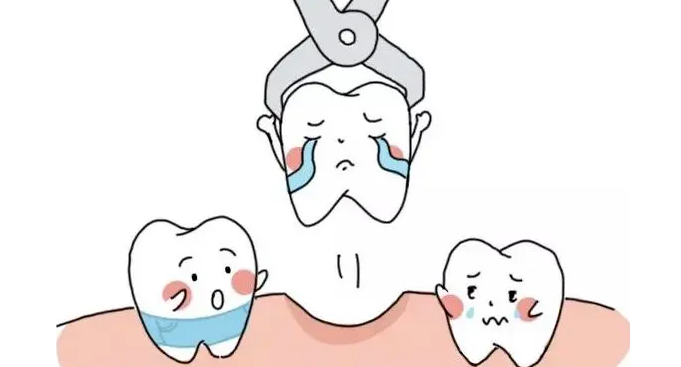正畸拔牙4顆真實實例牙好一生網(wǎng)