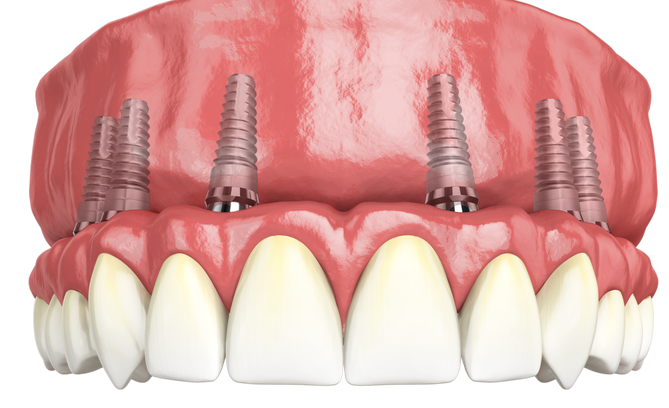 上海松江牙科收費(fèi)價目表m.a5aj.com