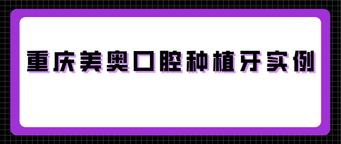 重慶美奧口腔種植牙實(shí)例