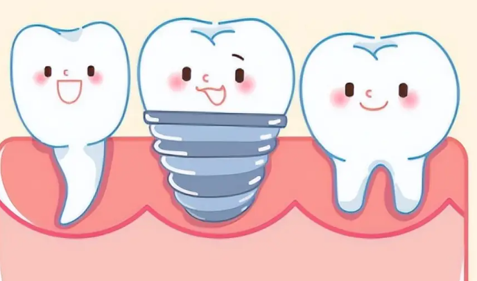 北京朗瑞口腔種植牙技術(shù)好