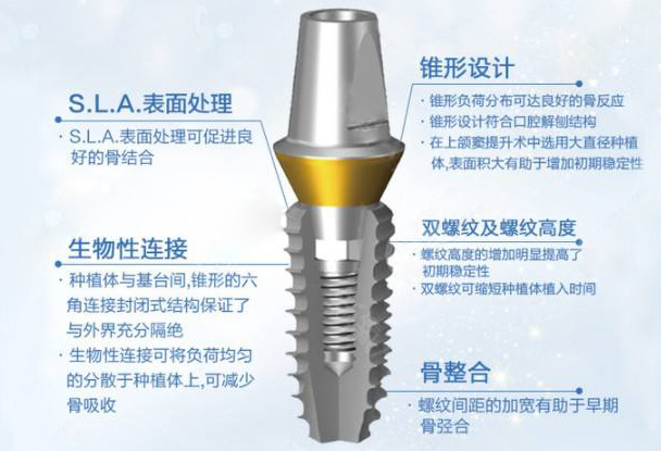長(cháng)春國建口腔種植牙價(jià)格中登騰植體便宜