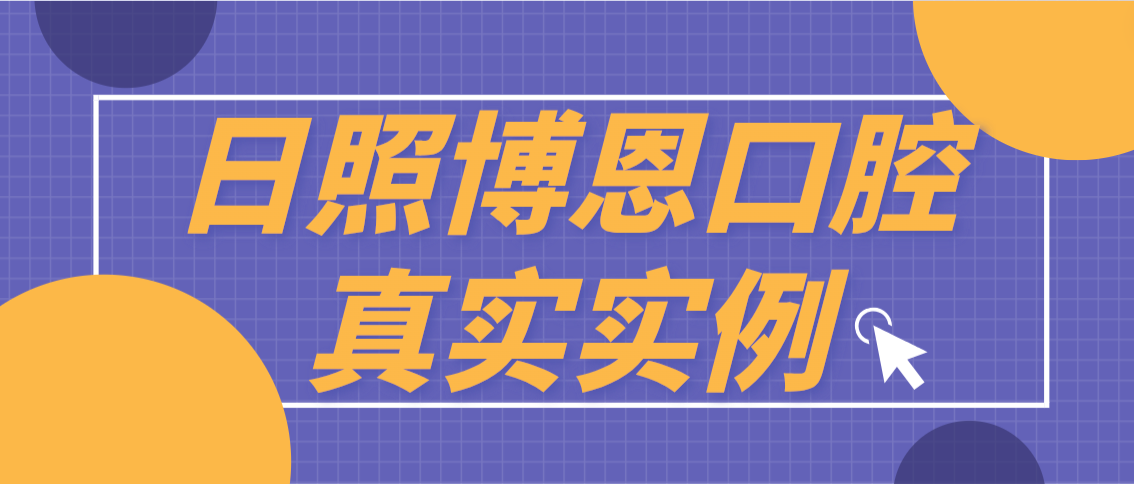 日照博恩口腔实例