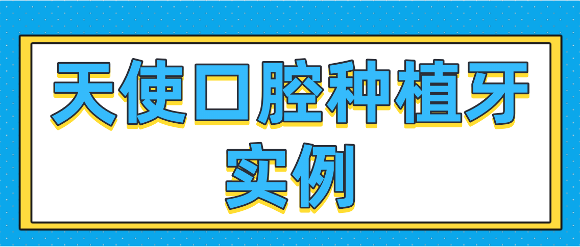 天使口腔种植牙实例分享