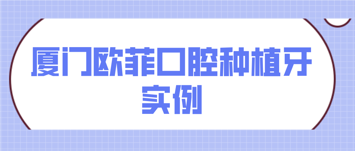廈門(mén)歐菲口腔種植牙實(shí)例分享
