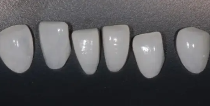 溫州要貼面醫(yī)院排名榜前十資料介紹