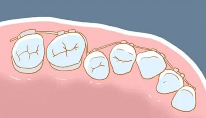 2025國內牙齒矯正醫院排名:牙齒矯正好的醫院前20家都是實(shí)力派