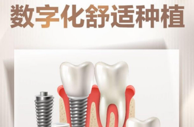 深圳穗華口腔作為數字化種牙基地-種牙技術(shù)靠譜