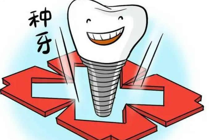【?？谥Z貝爾口腔種植牙收費(fèi)標(biāo)準(zhǔn)】其中紐白特種植牙價(jià)格2500起