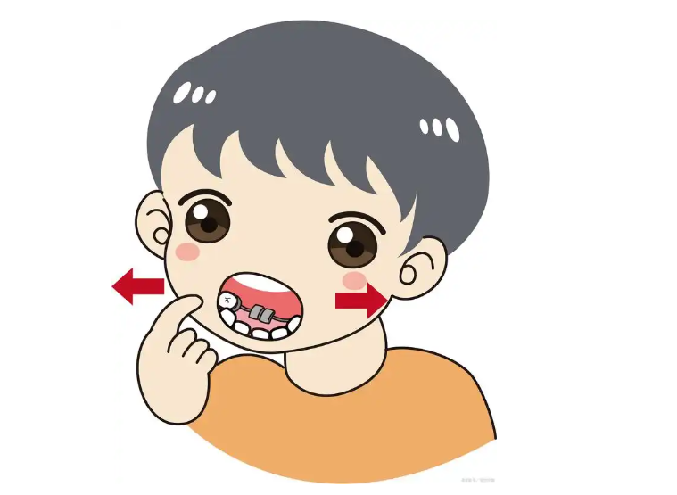 小孩下巴后縮能矯正好嗎？6-12歲是關(guān)鍵，家長(cháng)別錯過(guò)！